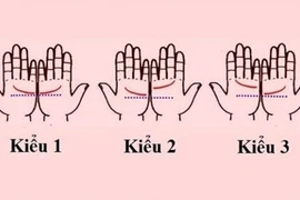 Xòe bàn tay và xem điều này để biết hôn nhân viên mãn hay trục trặc