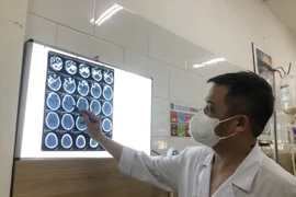 Nhiễm methanol trong nhà máy, 37 công nhân ngộ độc, một người tử vong