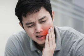 Chàng trai 24 tuổi hóa trẻ con chỉ vì 3 chiếc răng thối