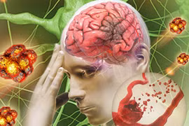 Những thực phẩm tăng khả năng bị nhồi máu não