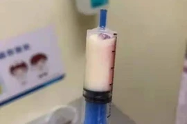 Đau bụng đi khám, chàng trai khiến bác sĩ hết hồn vì máu sữa