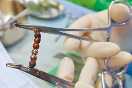 Bé 2 tuổi đau bụng, đi khám phát hiện chuyện kinh dị 