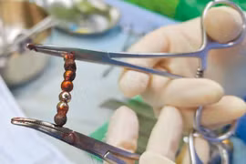 Bé 2 tuổi đau bụng, đi khám phát hiện chuyện kinh dị 