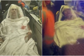 Bi kịch ghen tuông: 2 mẹ con bị dội nước sôi khi đang ngủ 