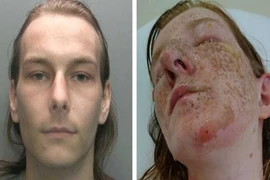 Cô gái bị em trai chồng sắp cưới dội nước sôi vì...thú cưng