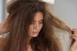 3 biểu hiện của tóc cho thấy gan có vấn đề