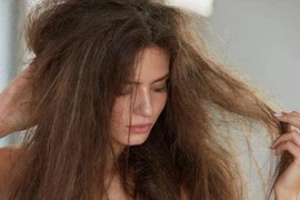 3 biểu hiện của tóc cho thấy gan có vấn đề