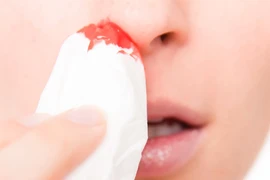 Thu hanh khô, chảy máu mũi tưởng đơn giản ai ngờ ung thư
