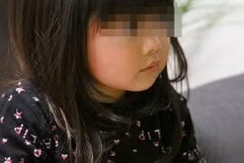 Bé gái 7 tuổi đột nhiên mờ mắt vì bố mẹ làm điều này 