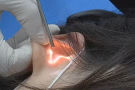 Bạn trai làm điều này khi ân ái, cô gái cầu cứu bác sĩ