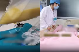 Bé gái 13 tuổi khiến bác sĩ sợ tái mặt vì điều này