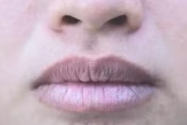 Phổi hư, cơ thể hiện rõ 3 dấu hiệu này 