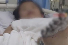 Bé gái nguy cơ cắt cụt chi vì dùng điện thoại kiểu này 