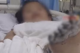 Bé gái nguy cơ cắt cụt chi vì dùng điện thoại kiểu này 