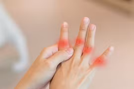 Thấy 3 dấu hiệu này ở bàn tay, khám phổi ngay còn kịp