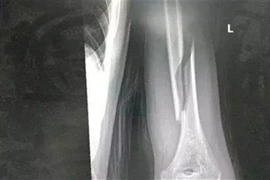 Mất ngủ, cha và con bày trò lạ, gặp chuyện kinh dị 