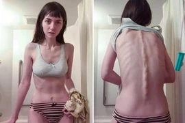 Tưởng cắt dạ dày cứu mạng, hóa ra gái trẻ làm điều kinh khủng...