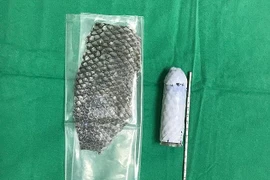 Không thể quan hệ tình dục, người phụ nữ lấy da cá rô phi làm "vùng kín"