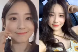 Lột xác thành công, gái xinh Hàn Quốc kiếm tiền tỷ mỗi năm