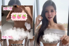 Bị nghi ngờ phẫu thuật thẩm mỹ, nữ streamer tung luôn ảnh chứng minh 