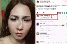 Người phụ nữ tố chồng đánh "tòe mũi" mới nâng đâu là sự thật?