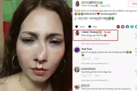 Người phụ nữ tố chồng đánh "tòe mũi" mới nâng đâu là sự thật?