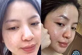 Mặt mộc "tàn tạ" của vợ cầu thủ Quang Hải làm fan lo lắng