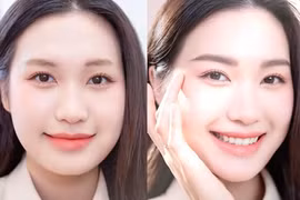 Doãn Hải My thẩm mỹ 2 điểm trên mặt, nhan sắc ra sao?