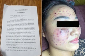 Thêm khách hàng bị lệch mặt sau khi làm đẹp ở spa "cỏ" Hà Nội