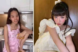 Đi sửa mũi giá 300 triệu, TikToker Đồng Tháp "vịt hoá thiên nga"