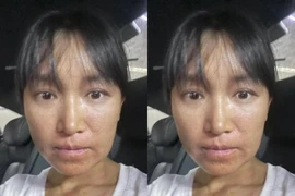 Lý Tử Thất lộ ảnh cận gương mặt làm fan lo lắng