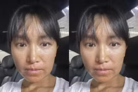 Lý Tử Thất lộ ảnh cận gương mặt làm fan lo lắng