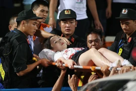 Fan nữ trúng pháo sáng CĐV Nam Định: VFF có “động thái” gì?