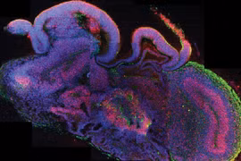 "Rúng động" các nhà khoa học tạo phôi não người