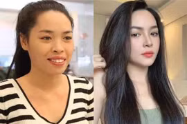 Rời NALA, hot girl đổi đời nhờ phẫu thuật thẩm mỹ giờ ra sao?