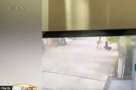 Bé trai khâu hơn 200 mũi vì bị chó dữ tấn công