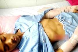 Nghệ An: Mâu thuẫn nhỏ, chém trọng thương cha con hàng xóm