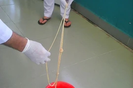 Kinh hãi sán xơ mít dài 7m làm tổ trong bụng người đàn ông ở Quảng Nam