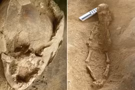 Giật mình hài cốt trẻ em 2.000 tuổi “đội mũ” hộp sọ 