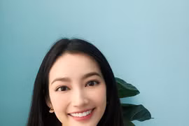 Một thời bị đồn thổi “dao kéo” Á hậu Trúc Diễm bây giờ đẹp miễn chê