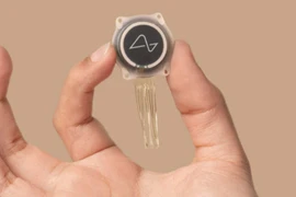 Kết quả cấy ghép chip não cho người thứ 2 của Elon Musk như thế nào?