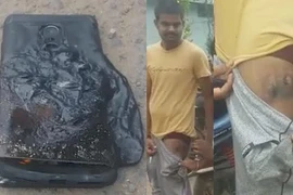 Smartphone "nhái" Galaxy Note 7 bất ngờ phát nổ trong túi người dùng