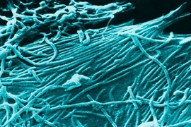 Thử nghiệm vắc xin Ebola an toàn trên người