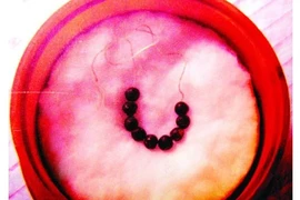 Giải mã xá lợi đẹp như ngọc của cao tăng nước Việt