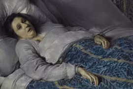 Biết gì về bệnh lạ khiến con người giống như xác sống?