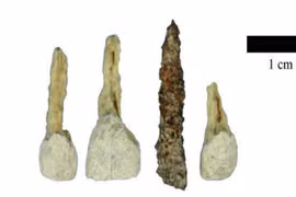 Khai quật mộ cổ, phát hiện sốc cách người xưa chăm sóc, làm đẹp răng