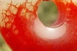 Khai quật mộ cổ, chuyên gia xanh mặt thấy khối huyết ngọc “ma quái” 
