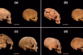 Vì sao người xưa có tập tục kéo dài hộp sọ dài như quả trứng?