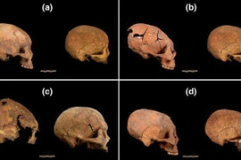 Vì sao người xưa có tập tục kéo dài hộp sọ dài như quả trứng?