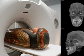 'Nội soi' xác ướp quý bà Ai Cập, lộ chi tiết khiến chuyên gia sững sờ 